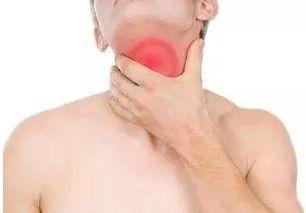 吃小白瓜喉咙痒,揭秘食用禁忌与应对策略